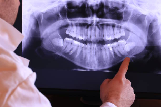 Best Emergency Root Canal Treatment in Cambridge, MD