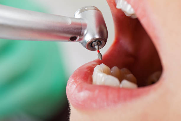 Best After-Hours Emergency Dentist in Cambridge, MD
